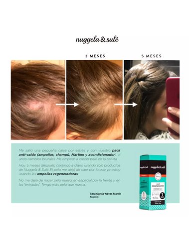 Regenerador Capilar 1Amp 10Ml. de Nuggela & Sule
